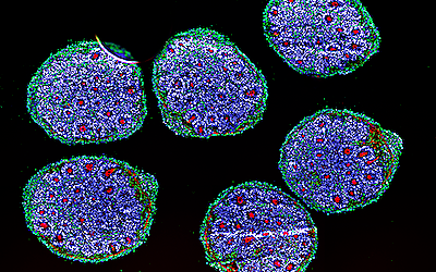 Brain Organoids and Rett Syndrome